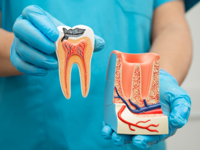 Recognizing the Signs of a Failed Root Canal