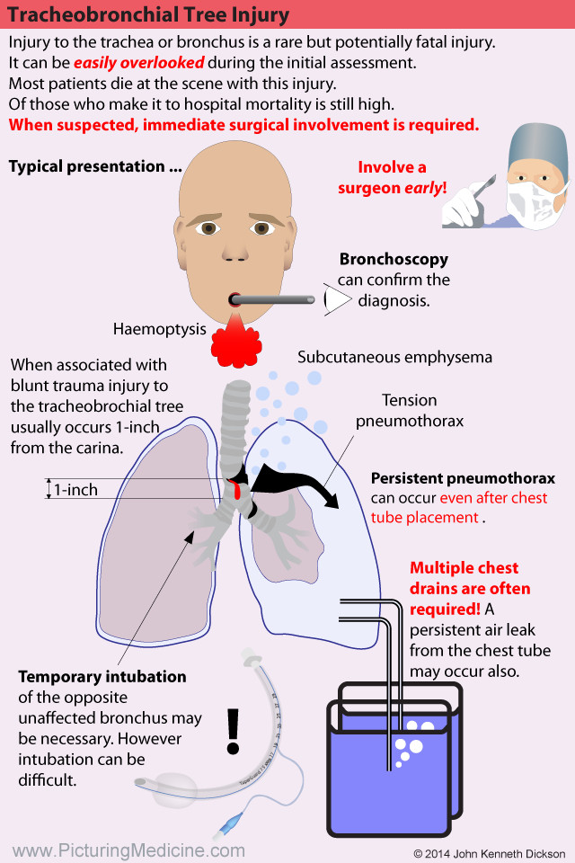 Tracheobronchial Tree Injury
