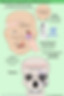 Zygomatic Fractures Diagram