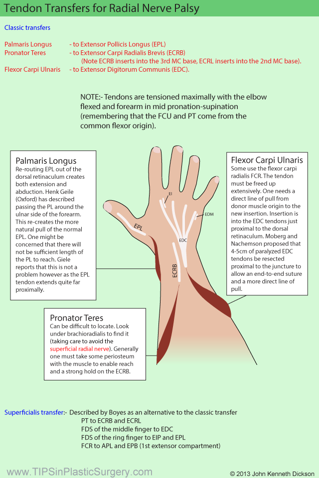 Wallpaper Tendon Transfers For Radial Nerve Palsy Tipsinplasticsurgery For Free