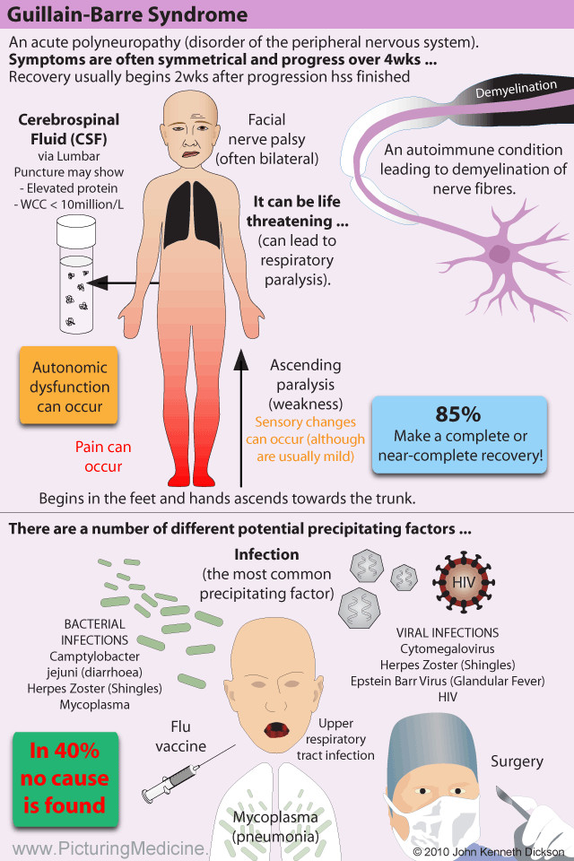 Gullain Barre Syndrome