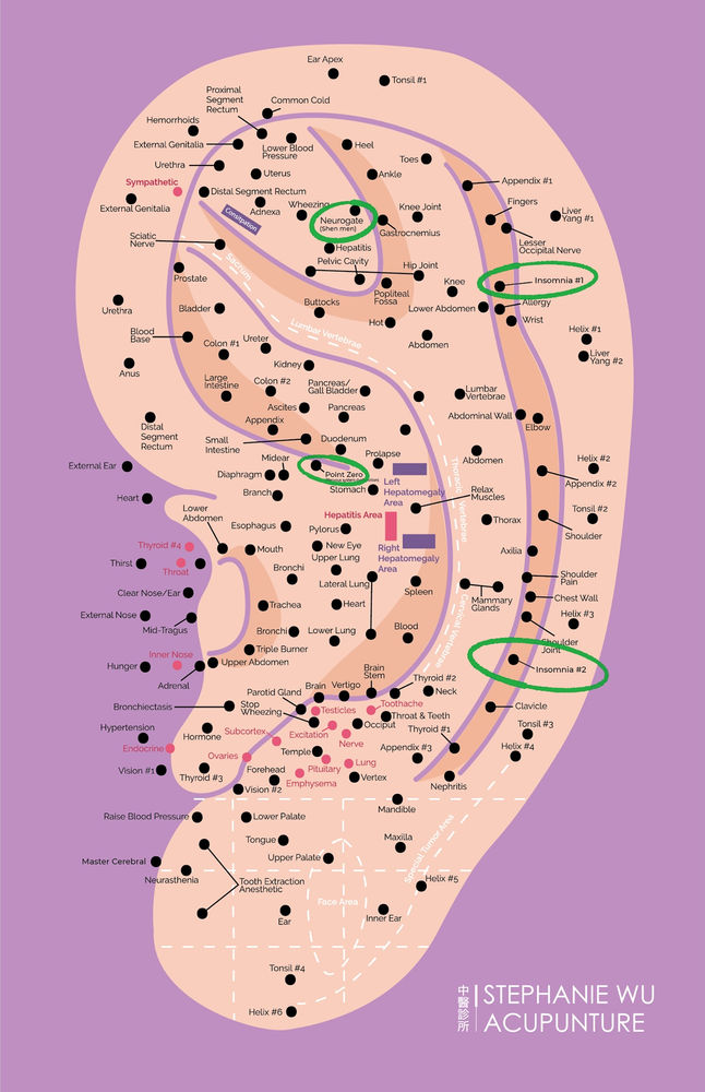 3 Minute DIY Acupressure Ear Seeds For Better Sleep