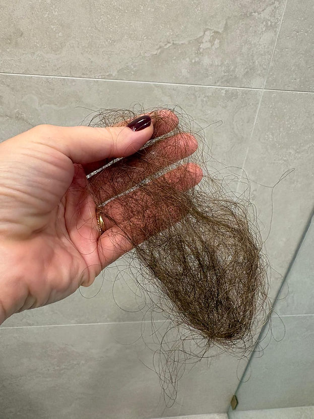 Problem_Hair loss_Shower_shedding (8).jpeg