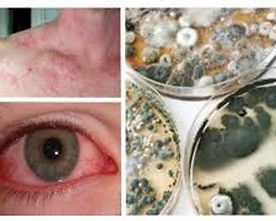 mold contaminatio and eye skin