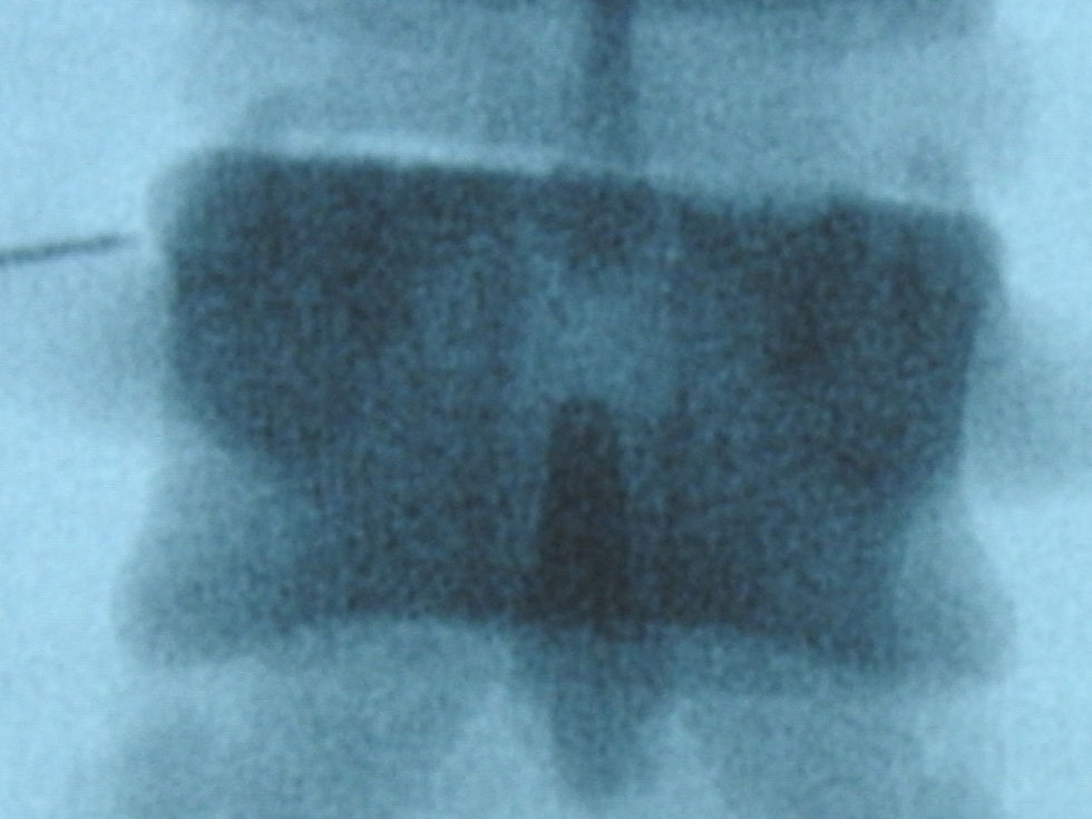 Hands-On Radiofrequency Ablation Course