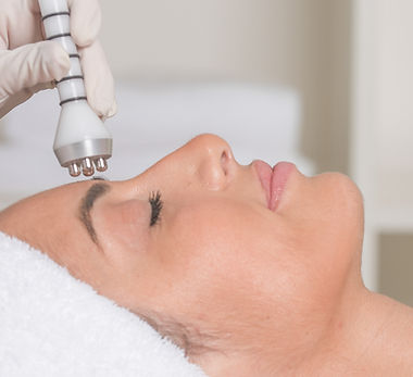 radiofrequencia facial