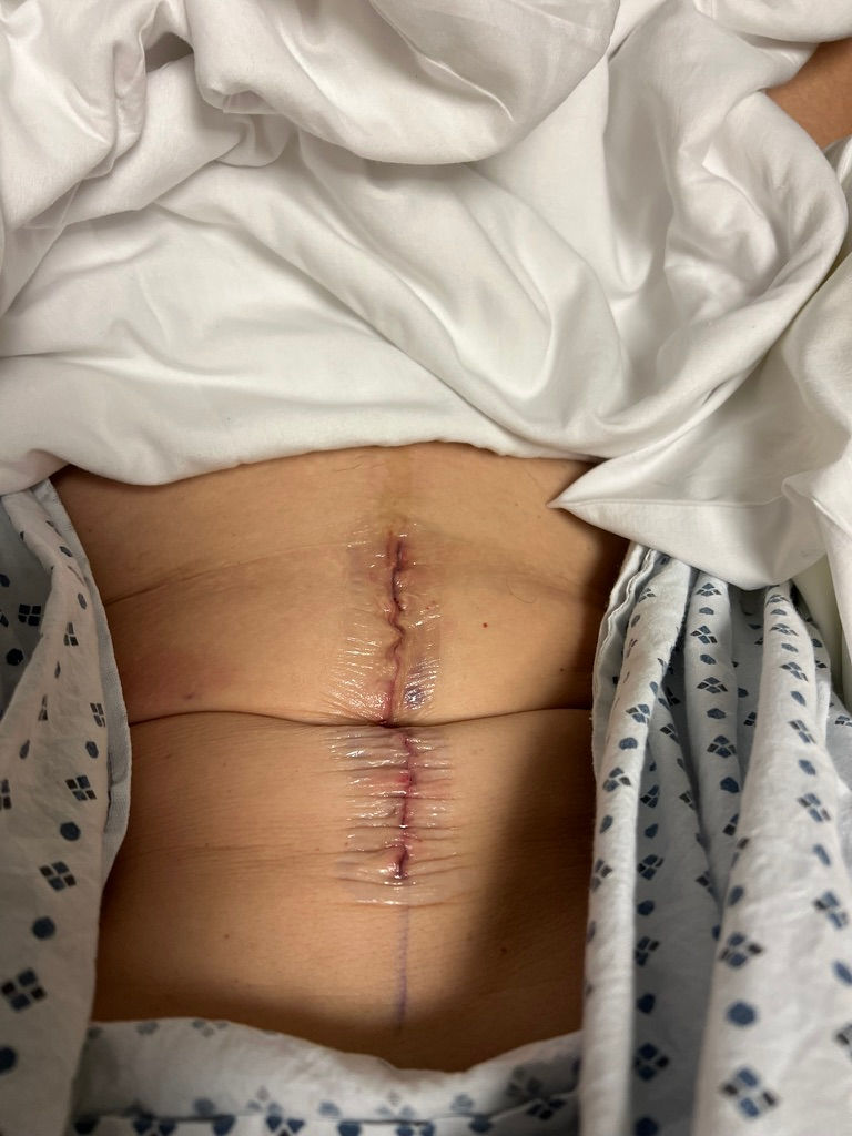 You'd think my bikini days are over, but no. I'll still wear one. Christina Zenato convinced me it's the best way to stay warm on the water. Yes, I have scars—I'm a patchwork quilt after 2 total hips, gallbladder removal, pinned wrist and more—but I'm 62 and I don't care about the scars anymore. I just care about being as healthy as I can be. :)