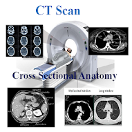 CT Scan Anatomy