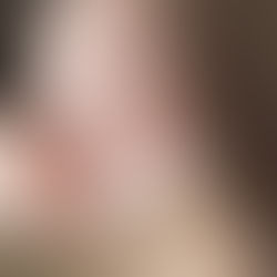 AKNE IST NICHT DAS PROBLEM – es ist der Wegweiser zu deiner ganzheitlichen Lösung! Die Behandlung von Akne muss ganzheitlich erfolgen.