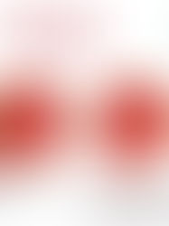 The Clotting Cascade and Haemophilia A