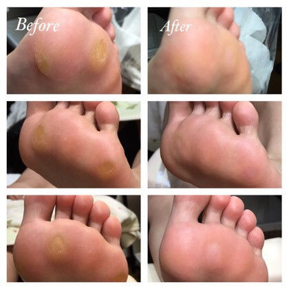 マシン フットケア 講習のご案内です