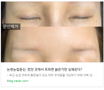 헤어스트록? 이 글 하나로 정리해 드립니다.