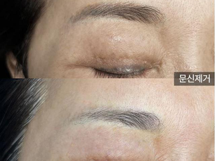 압구정눈썹문신, 분명 사진은 자연스러웠는데 진해진 이유는?