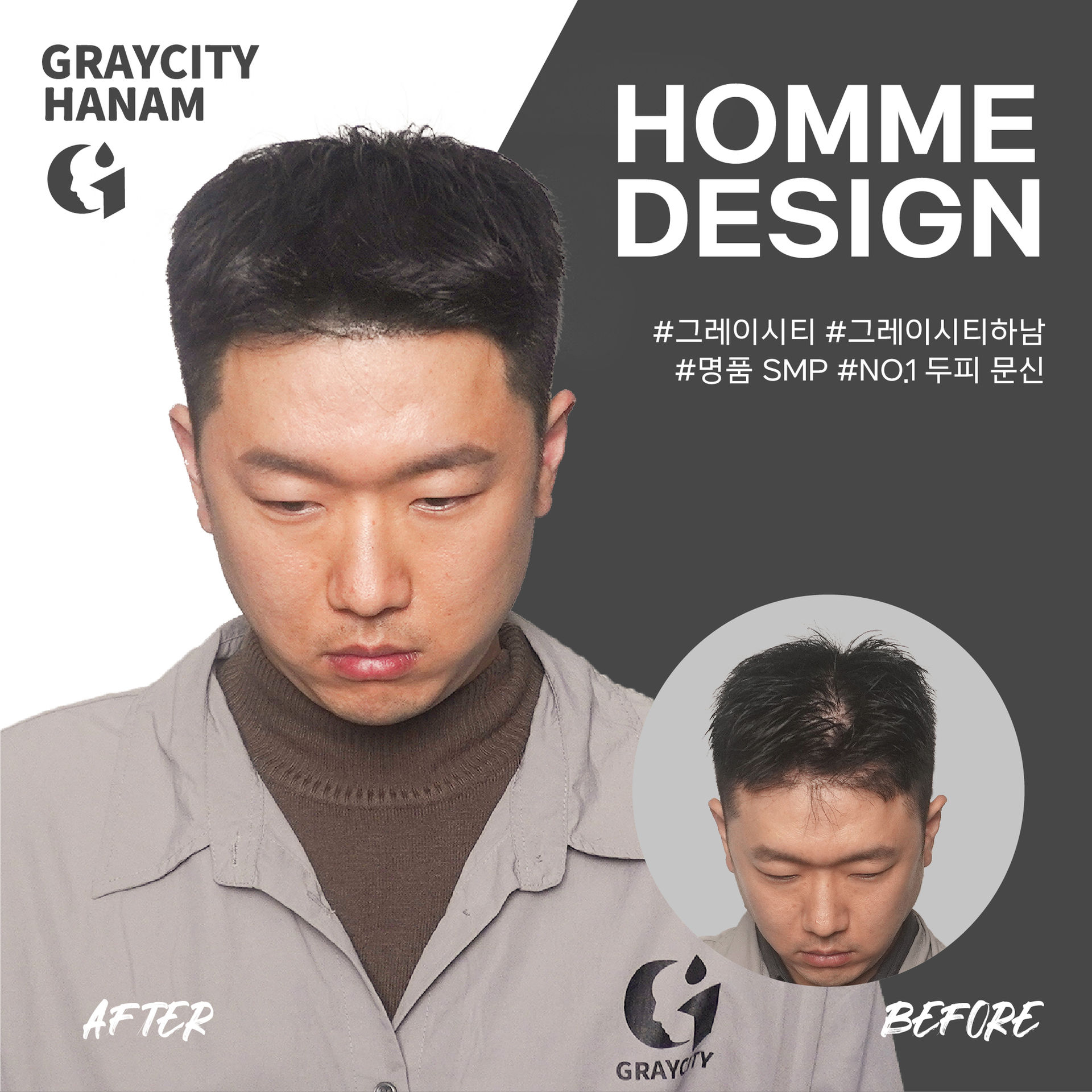 구준엽이 인정한 하남두피문신! 그레이시티 하남점! 머리카락이 자란 듯 자연스러운 탈모 커버!