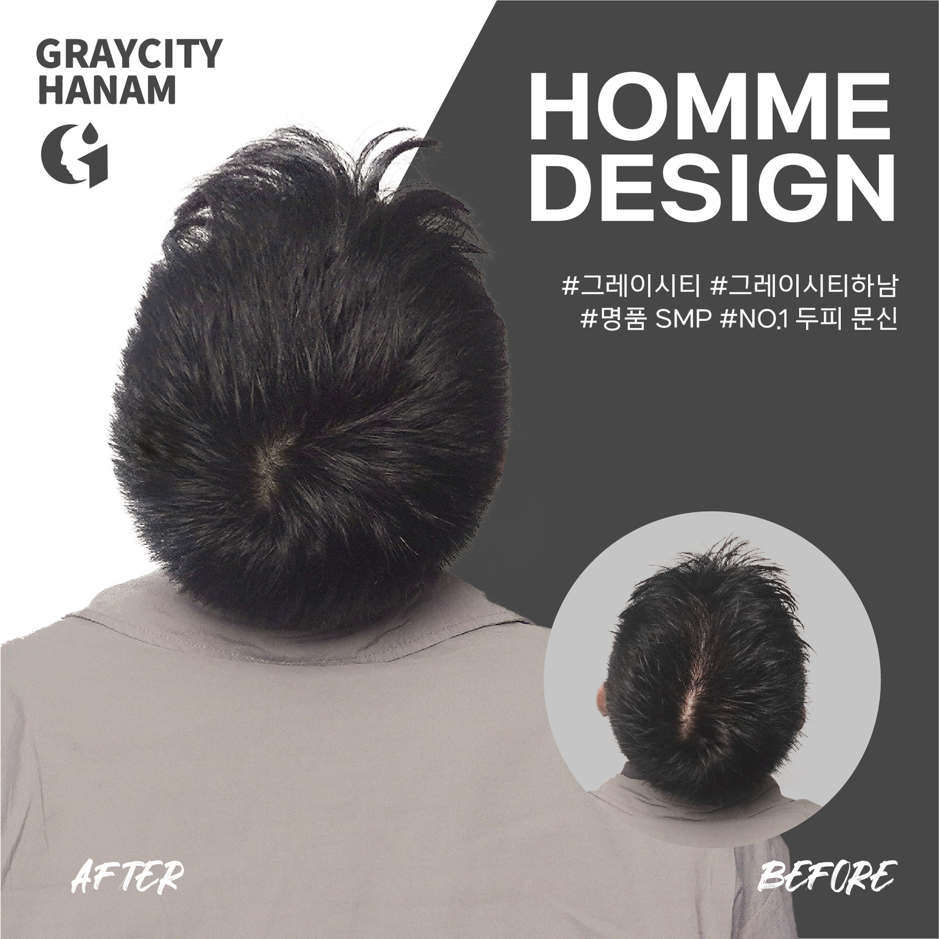 구준엽이 인정한 하남두피문신! 그레이시티 하남점! 머리카락이 자란 듯 자연스러운 탈모 커버!