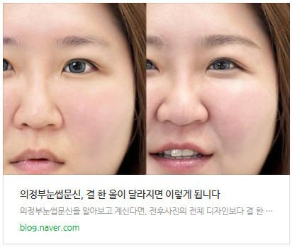 김포반영구, 결 한 올이 달라야 전부가 달라집니다