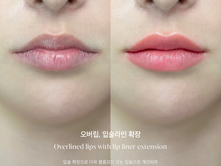 강남입술문신, 사실은 안아파야 합니다.