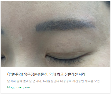강남남자눈썹문신, 다음날도 티 하나도 안났습니다