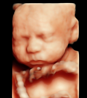 Baby 4D Scan