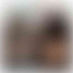 Before & After result of hair thinning treatment Singapore