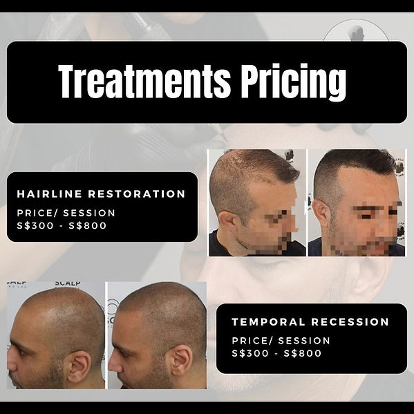 Affordable scalp micropigmentation Singapore price packages at The Scalp Studio