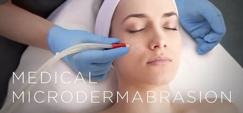 Medical-Microdermabrasion-Image_edited.jpg