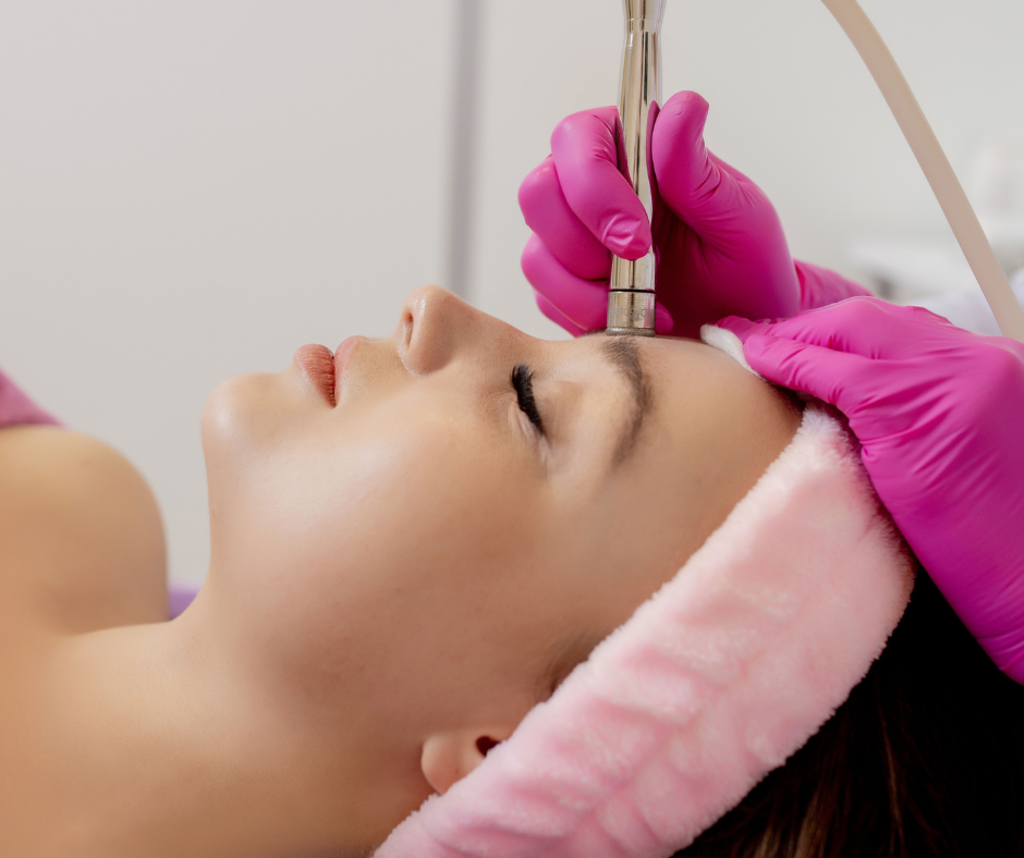lady getting microdermabrasion