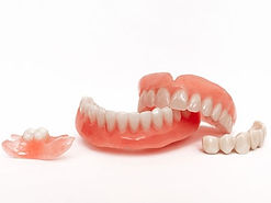teeth replacement | Denture