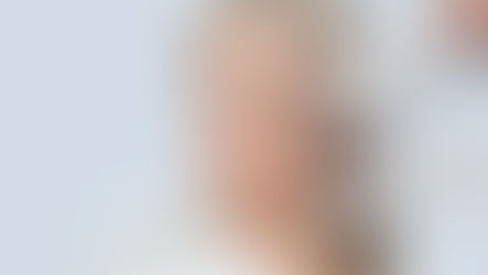 Plasma Fibroblast Therapy at LAVISHiBROWS