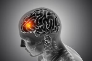 male-medical-figure-with-front-brain-highlighting-brain-tumor
