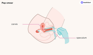ALL THINGS CERVICAL CANCER
