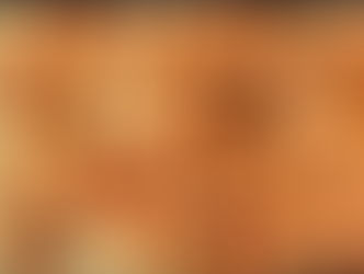 Cutibacterium acnes is the reason oil shouldn't touch the scalp!