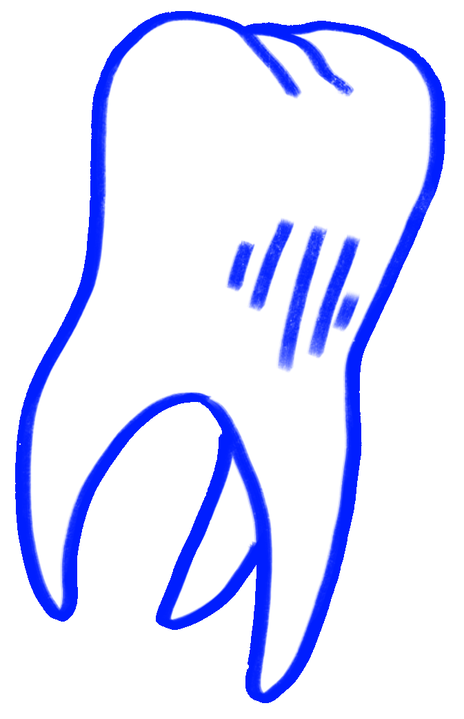 dent
