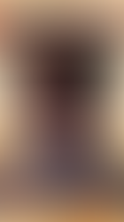 Mental Filter- Cognitive Distortion