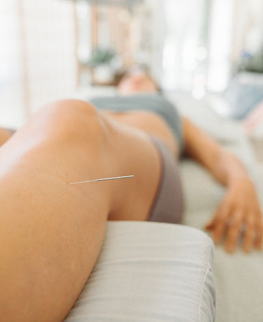 tendacupuncture_needleonleg.jpg