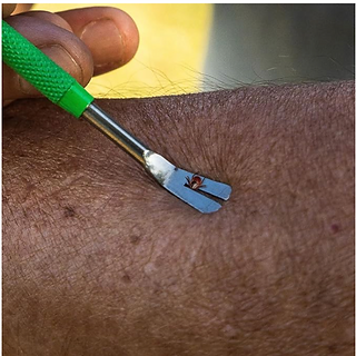 Removing a Tick from an Arm