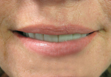Permanenet Lip Blush