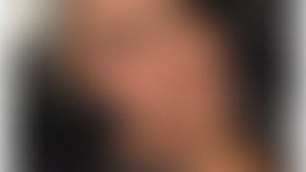 Elevate Your Skin Care Routine with Hydrafacials