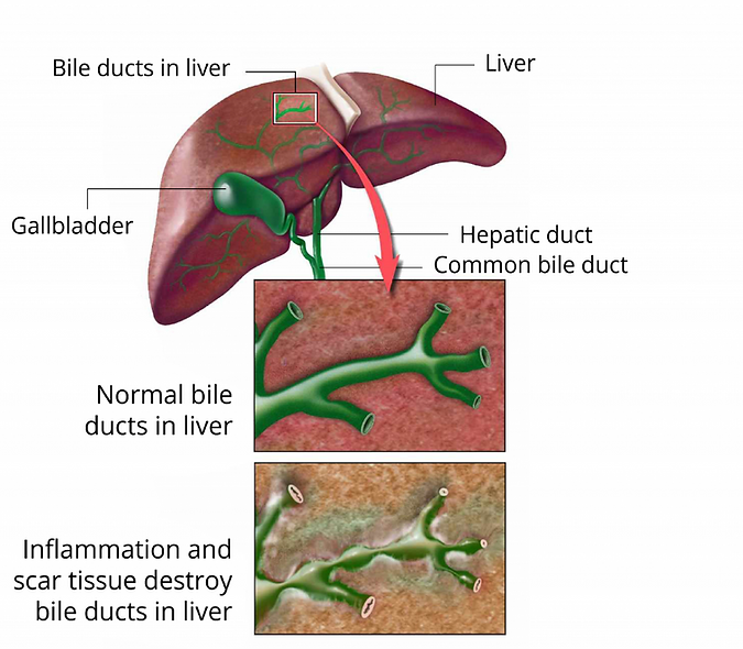 duct liver.png