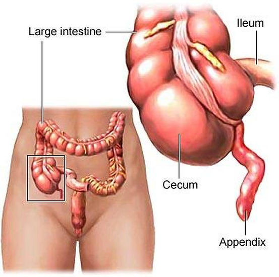 Picture of Cecum.jpg