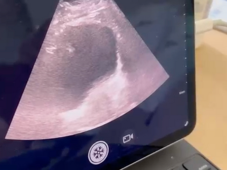 How Ultrasound Can Help You Make Sense of Your Pelvic Health