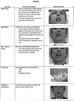 TERAPIA MANUAL E EXERCÍCIOS PARA PACIENTES COM DISFUNÇÃO TEMPOROMANDIBULAR