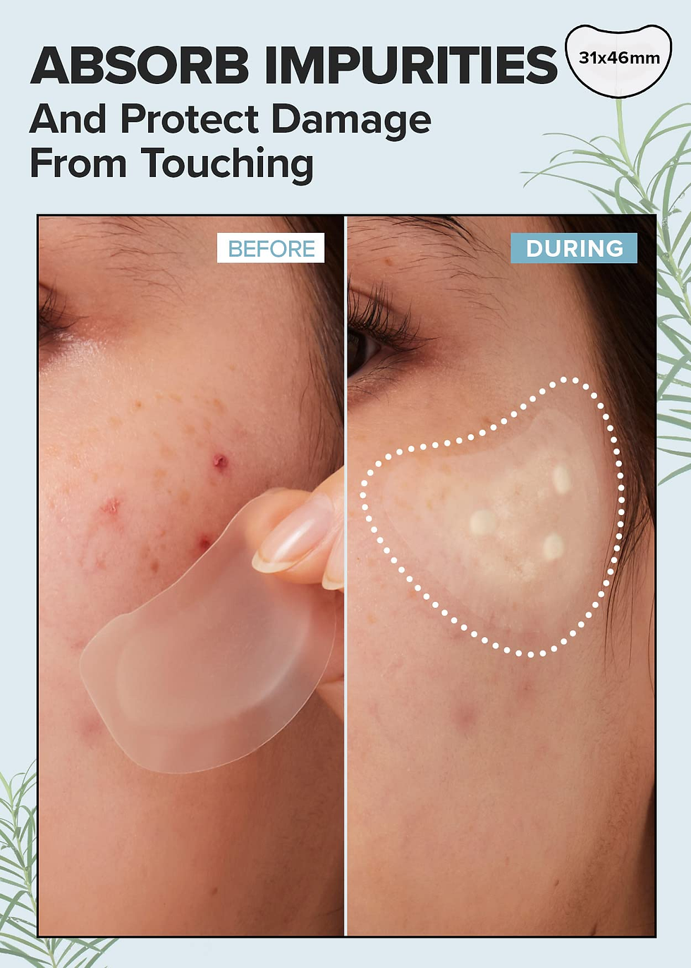 Miniature : I Dew Care - Timeout Patch Chin & Cheek ( 9X )