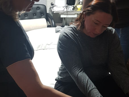 The outcome from Microneedling event on 18/02/2020