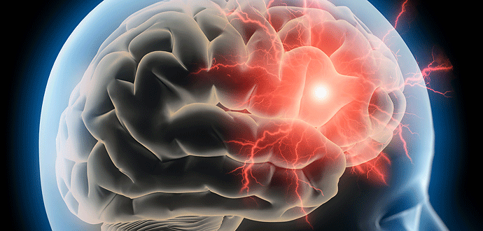 WHAT IS A SEIZURE?