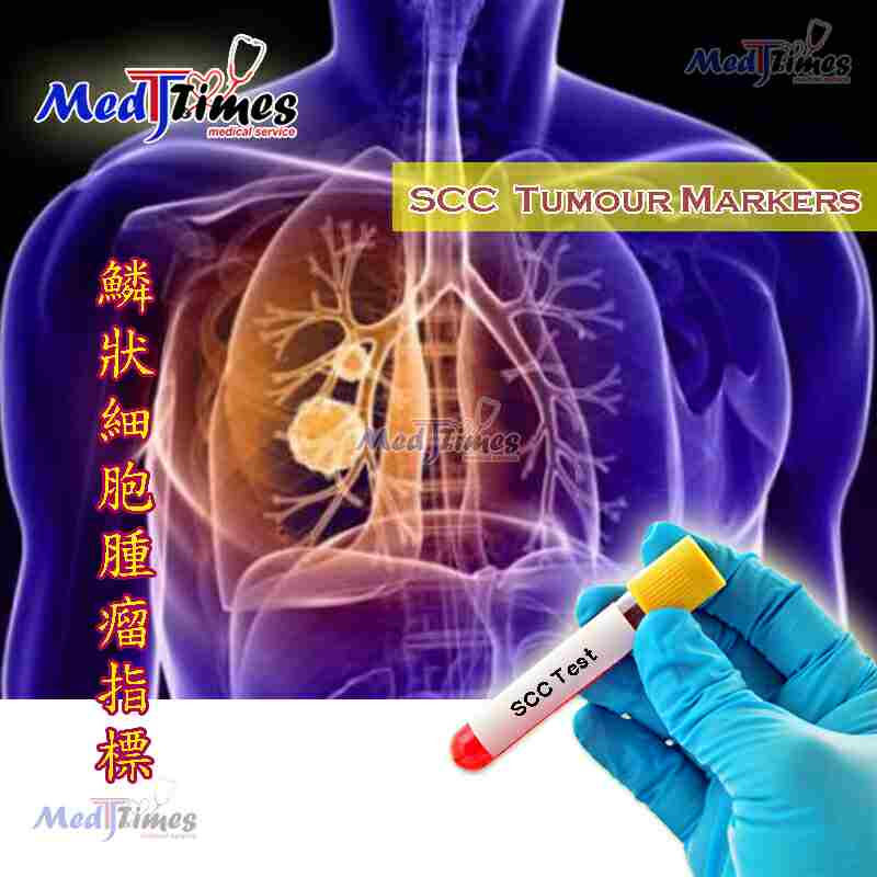 縮圖：女士癌症指標組合