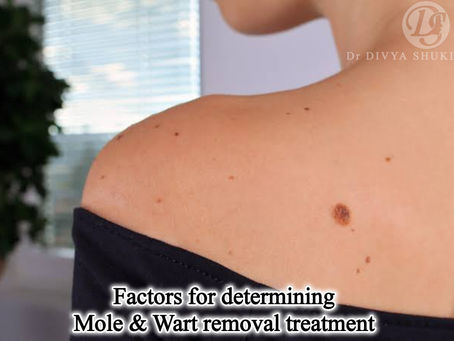 "What are the Key Factors for Determining the Best Mole and Wart Removal Treatment?"