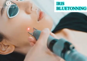 Unleashing the Power of Iris Bluetonning with MLA Technology"