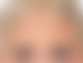 Understanding Botox Treatment: Insights from Dr. Divya Shukla, Top Dermatologist in Karnal