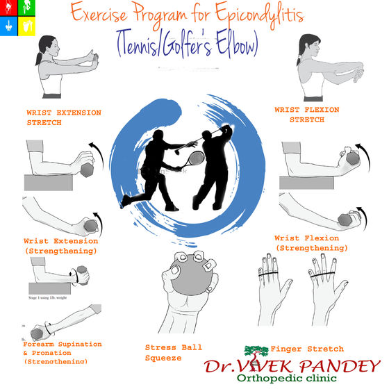 Exercise Program for Epicondylitis
(Tennis Elbow / Golfer’s Elbow)